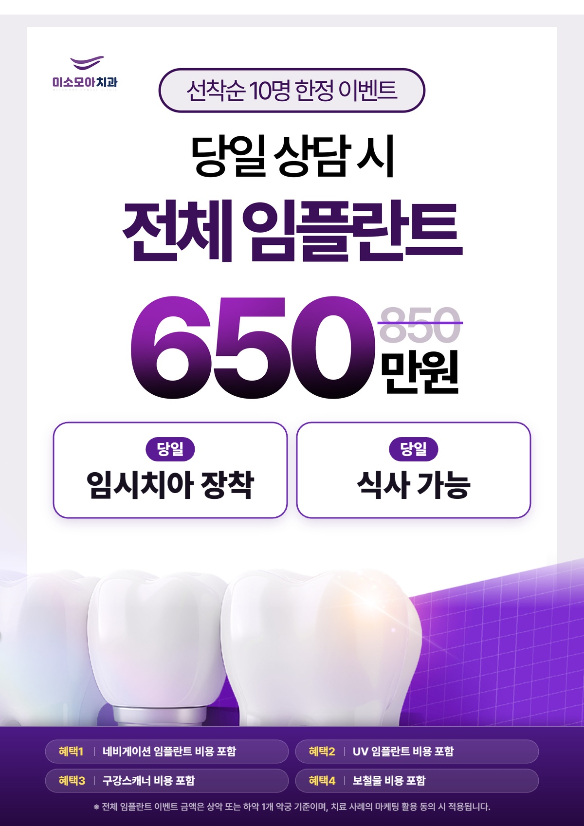 풀아치 임플란트 이벤트