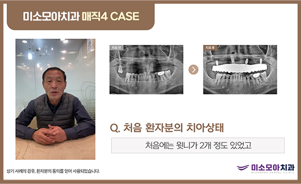 미소모아 치과 리얼스토리2